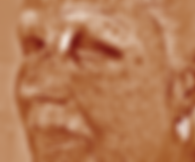 Scan showing that Halo has diminished the signs of sun damage on an older woman's face