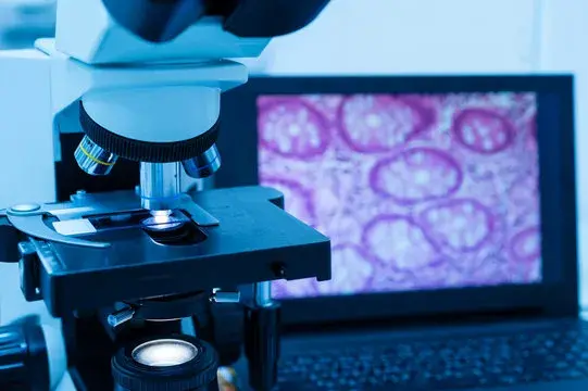 Digital pathology workstation—microscope linked to screen showing stained tissue sample for analysis.