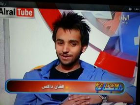 I’M GOING TO TALK TODAY ABOUT (DAX سأتكلم اليوم عن (داكس