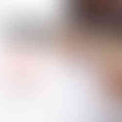 Stop PCOS Hair Fall Hack