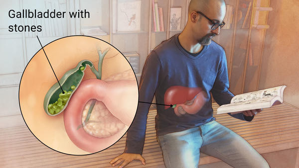 Benefits of having Cashew Kaju