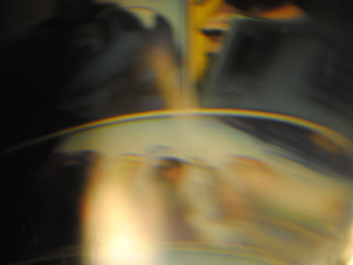 Acupuncture for Hormonal Imbalances & PMS