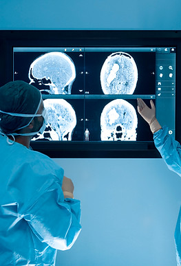 MRI Scans