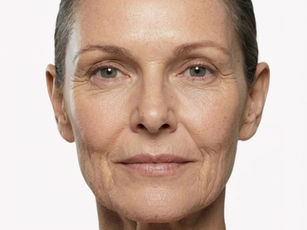 Older woman with short hair, neutral expression, close-up portrait on a white background, highlighting natural skin texture and features.