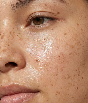 Close-Up Facial Skin