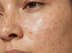 Close-Up Facial Skin