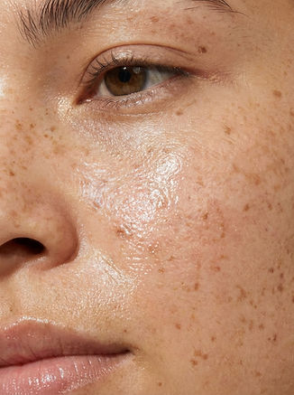 Close-Up Facial Skin