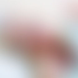 Schlafstörungen S3-Leitlinie