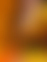 İyileşmenin Sessiz Koruyucusu:Terapide Sınırlar