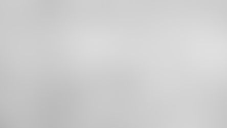 40代男性のシミ取りレーザー