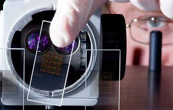 DNA Chips
