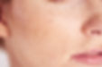 Close-Up Freckled Skin