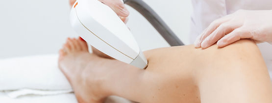 Laser Hair Removal