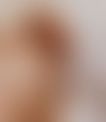 Auriculothérapie, Naturopathie et Ostéopathie : une approche complémentaire pour votre bien-être