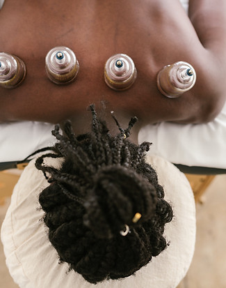 Cupping-therapie