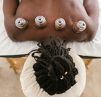 Cupping Therapy Session