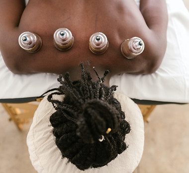 Cupping Therapy Session