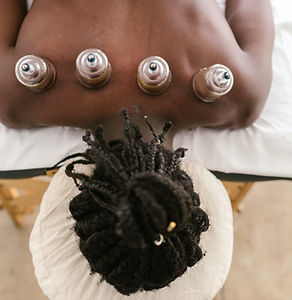 Cupping Therapy Session