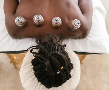 Cupping Therapy