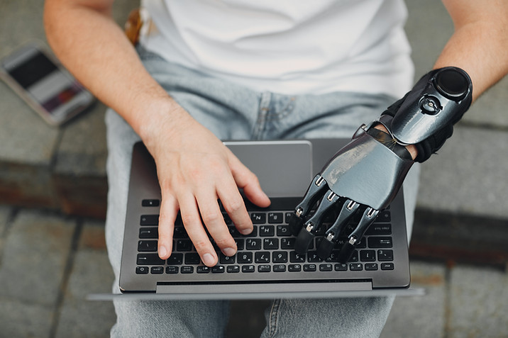 Typing with Prosthetic Hand