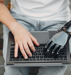 Prosthetic Hand Typing