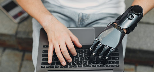Digitando com prótese de mão