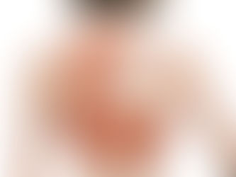 スウィングで脇腹が…。それ、肋間筋損傷かも!