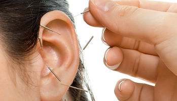 acupuncture therapy on auricle, horizontal very close up photo