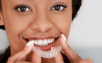 Invisalign Consultation