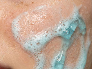 My Aklief Purge Timeline: How to Clear Closed Comedones Without Ruining Your Skin Barrier
