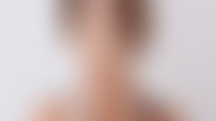 Jerawat? Kulit Berminyak? Percuma Pakai Skin Care Tanpa Paham Tipe Tubuhmu.