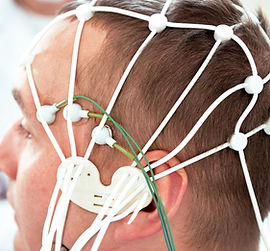 Encephalography