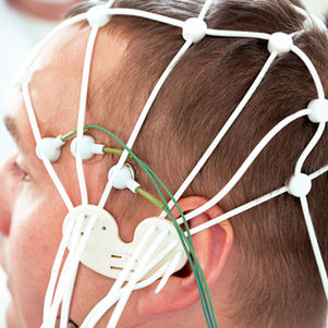 Functional Neurological Disorder