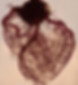 Vasculatura del corazón