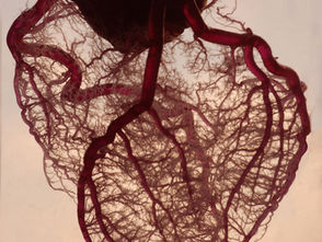 Prevenir el infarto y alimentación