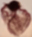 Vasculature of the Heart