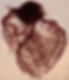 Vasculature of the Heart