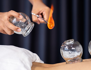 Cupping therapy
