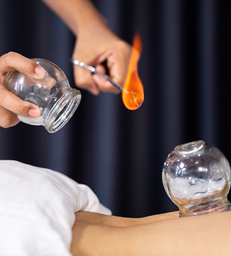 Terapia con ventosas