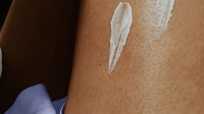 Hydrolyzed Collagen – Skin Deep or Just a Trend?