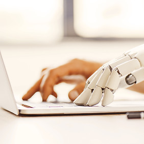 Prosthetic Hand