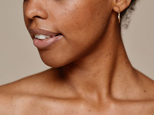 Three Ways to Get Rid of Dark Spots on Dark Skin