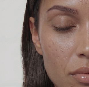 Close-Up Facial Skin