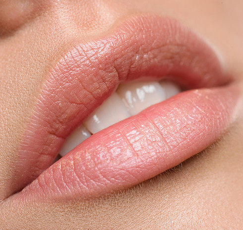 lip filler uxbridge and henley