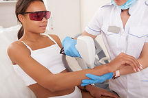 Épilation au laser