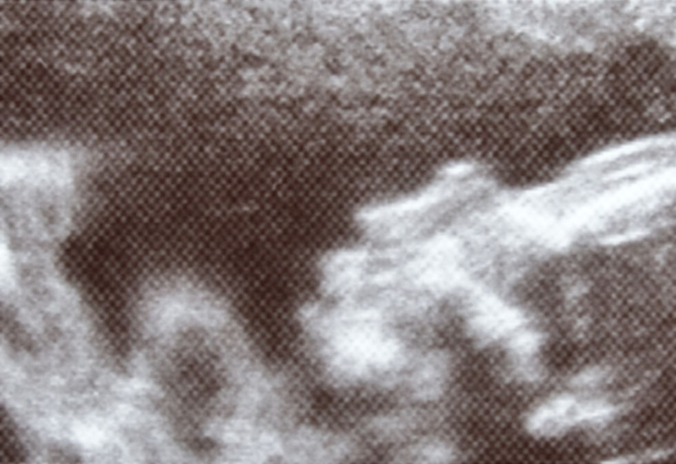 Ultrasound Scan Image