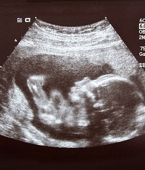 pierre-chatel-innocenti-Lk-nu_hX6ms-unsplash 2.png