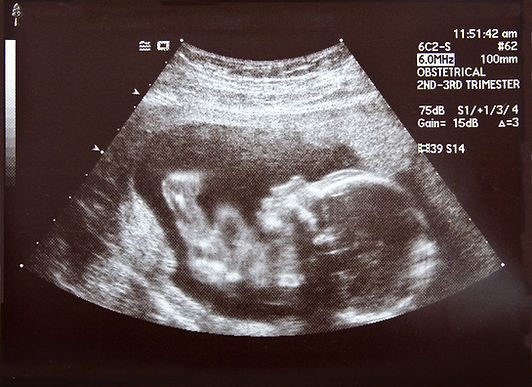 Ultrasound Scan Image