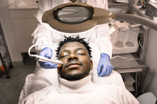 Needling Facial