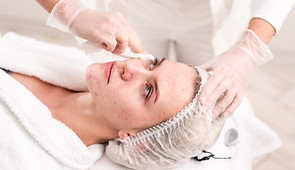 Tratamento da acne